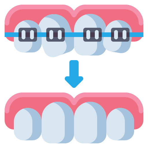 Braces Treatment